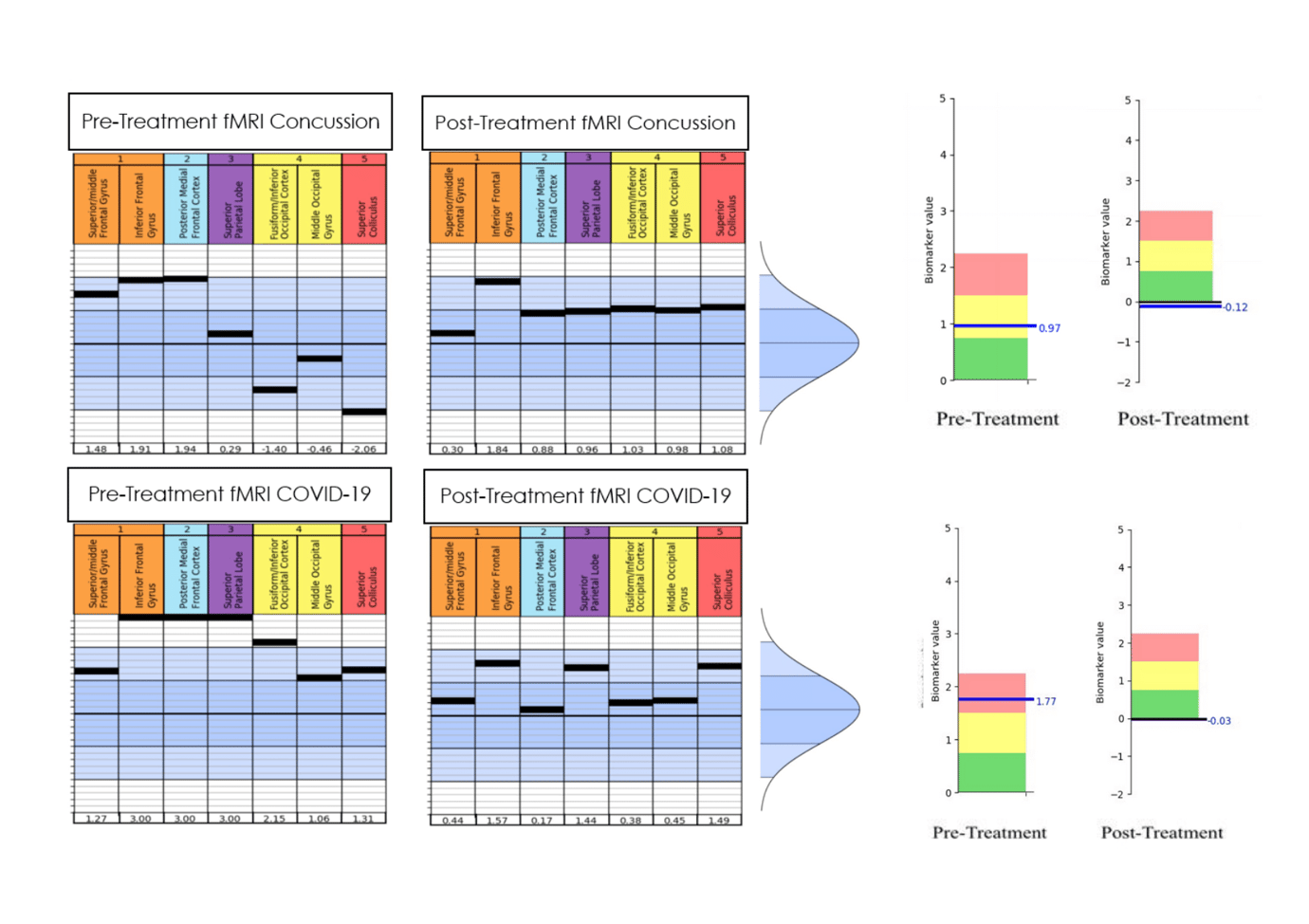 Post covid brain fog treatment think clearly again cognitive fx